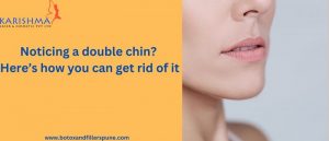 how to reduce double chin
